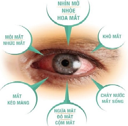 Thuốc bổ mắt Q&P kova Plus nhật bản