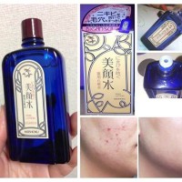 Nước hoa hồng trị mụn Meishoku Bigansui Medicated skin lotion 90ml
